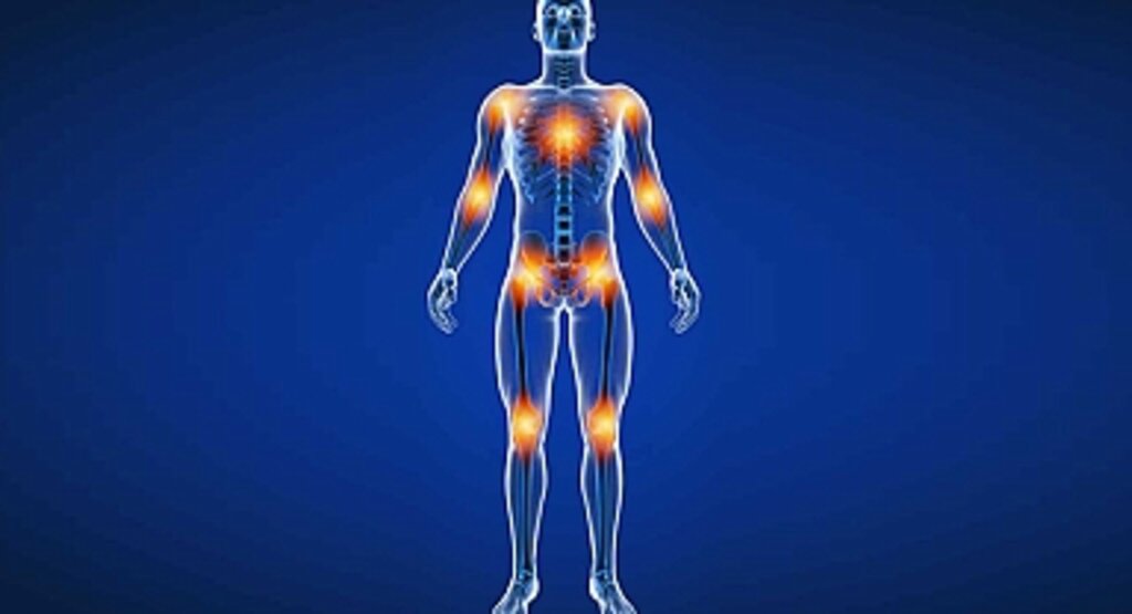 Fibromiyalji Nedir? Belirtileri, Nedenleri ve Tedavi Yöntemleri