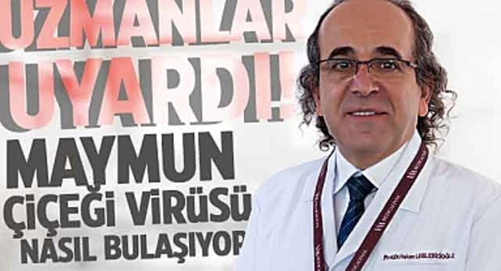 Maymun Çiçeği Virüsü Hakkında Uzman Uyarısı: Bulaşma Yolları ve Belirtiler