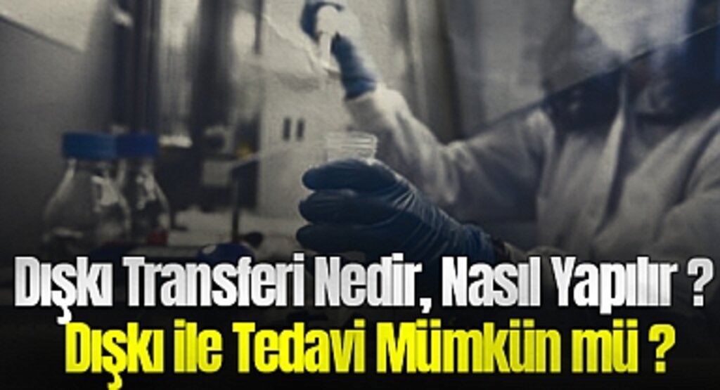 Dışkı Transferi Nedir, Nasıl Yapılır? Dışkı ile Tedavi Mümkün mü?