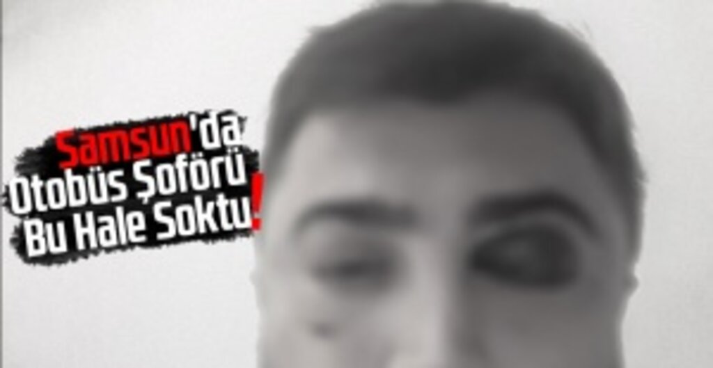 Samsun’da Halk Otobüsü Şoförü ve Sürücü Arasında Kavga: Bir Kişi Hastanelik Oldu