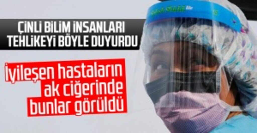 İyileşen Koronavirüs Hastalarının Akciğerlerinde Kalıcı Hasar Riski!