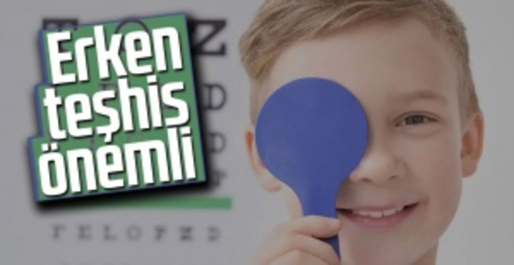 Göz Tembelliğinde Erken Teşhis Hayati Önem Taşıyor
