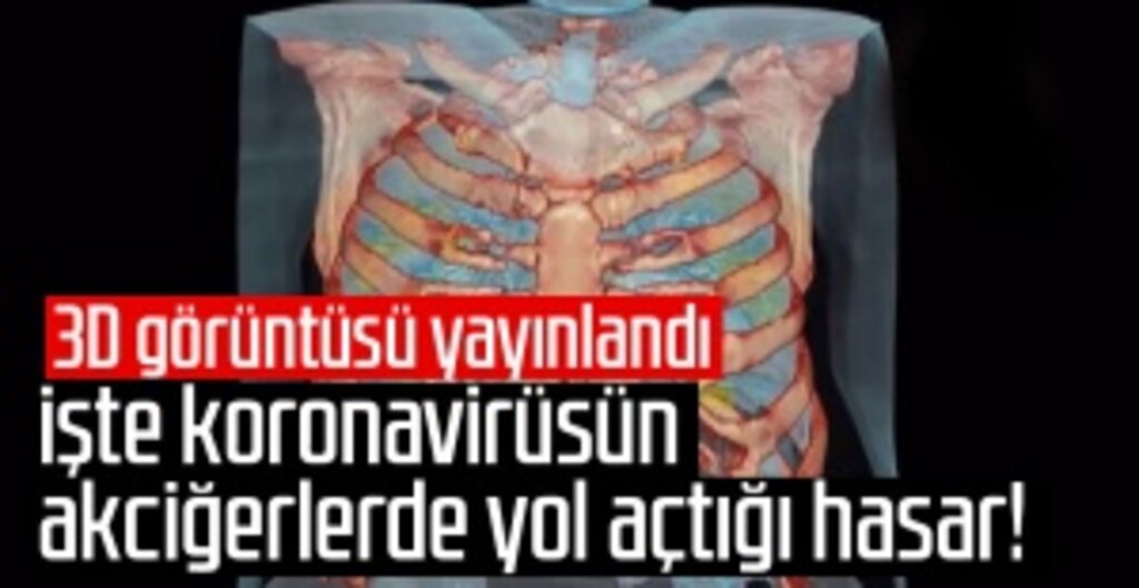 ABD'de Sanal Gerçeklik Teknolojisi ile Koronavirüs Hastasının Akciğerleri Görüntülendi