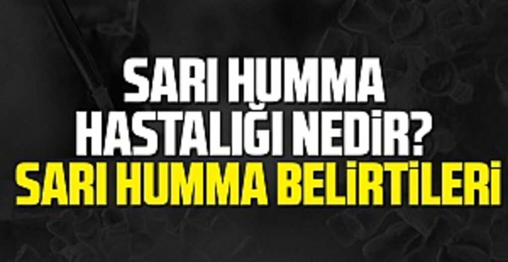 Sarı Humma Hastalığı Nedir? Sarı Humma Belirtileri